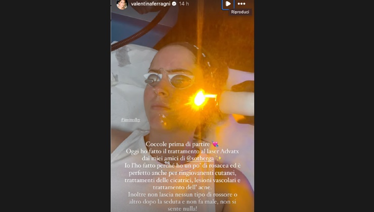 Valentina Ferragni spiega perché ha fatto il laser
